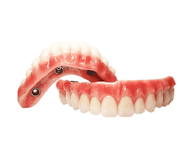 implante dentario