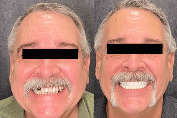 antes-e-depois-3.png