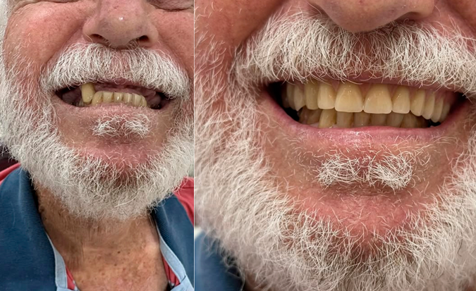 antes-e-depois-5-3.png