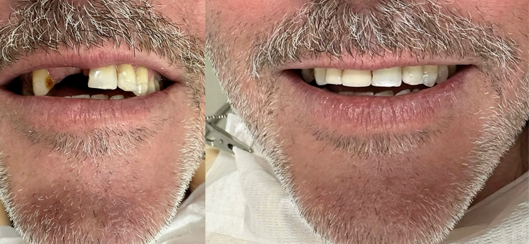 antes-e-depois-6.png