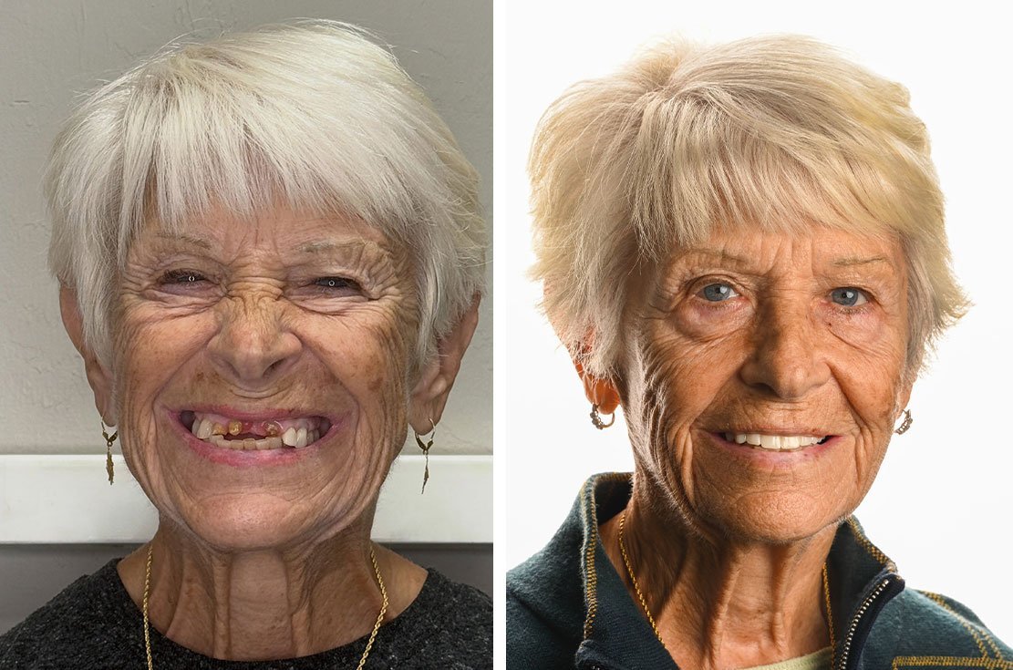 antes-e-depois-7.jpg