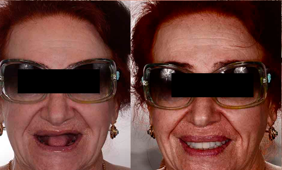 antes-e-depois-8.png