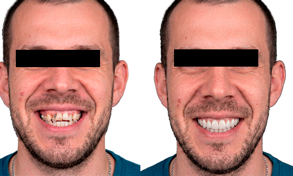 antes e depois 9